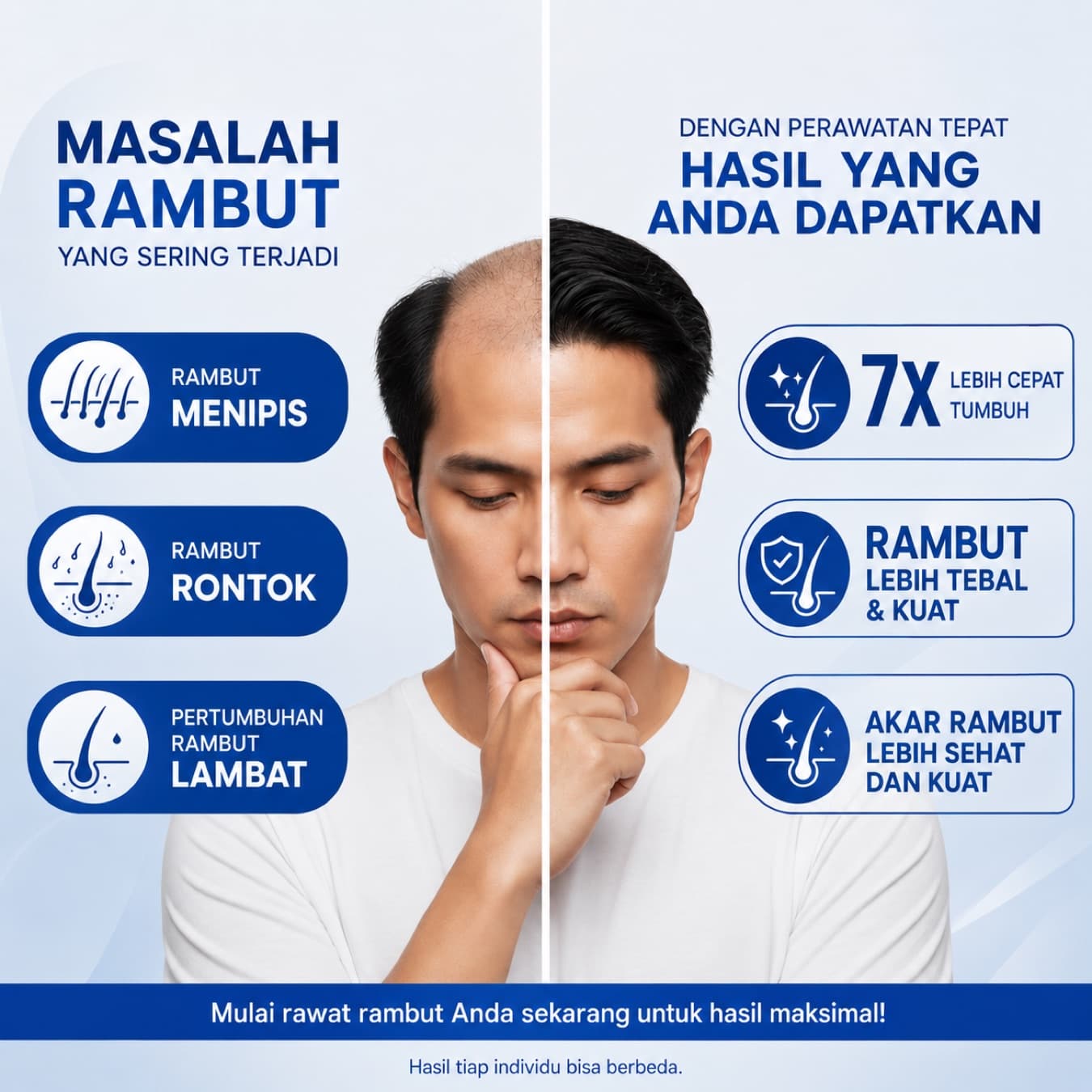 Rambut Menipis & Rontok di Usia 30+? Rawat Kembali dari Akarnya