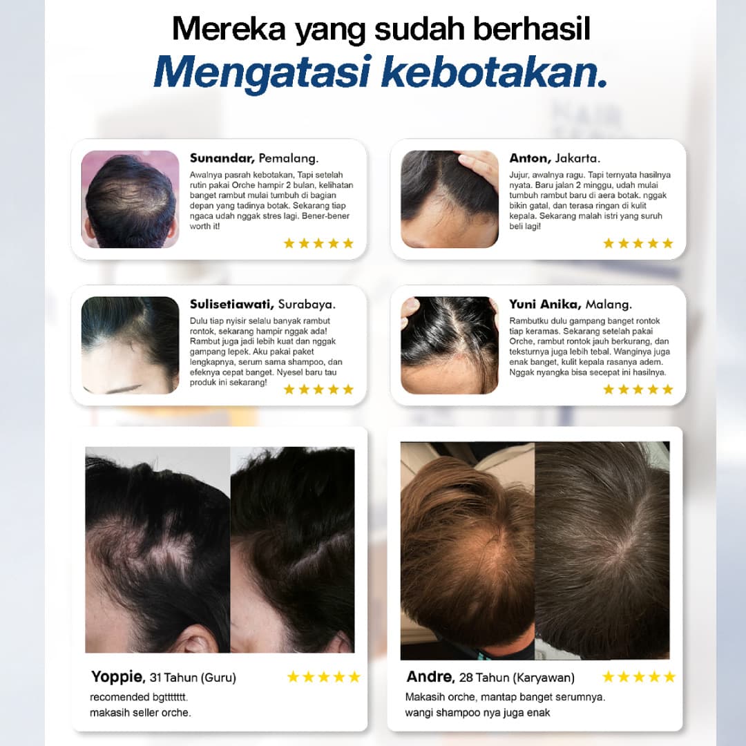 Rambut Menipis & Rontok di Usia 30+? Rawat Kembali dari Akarnya